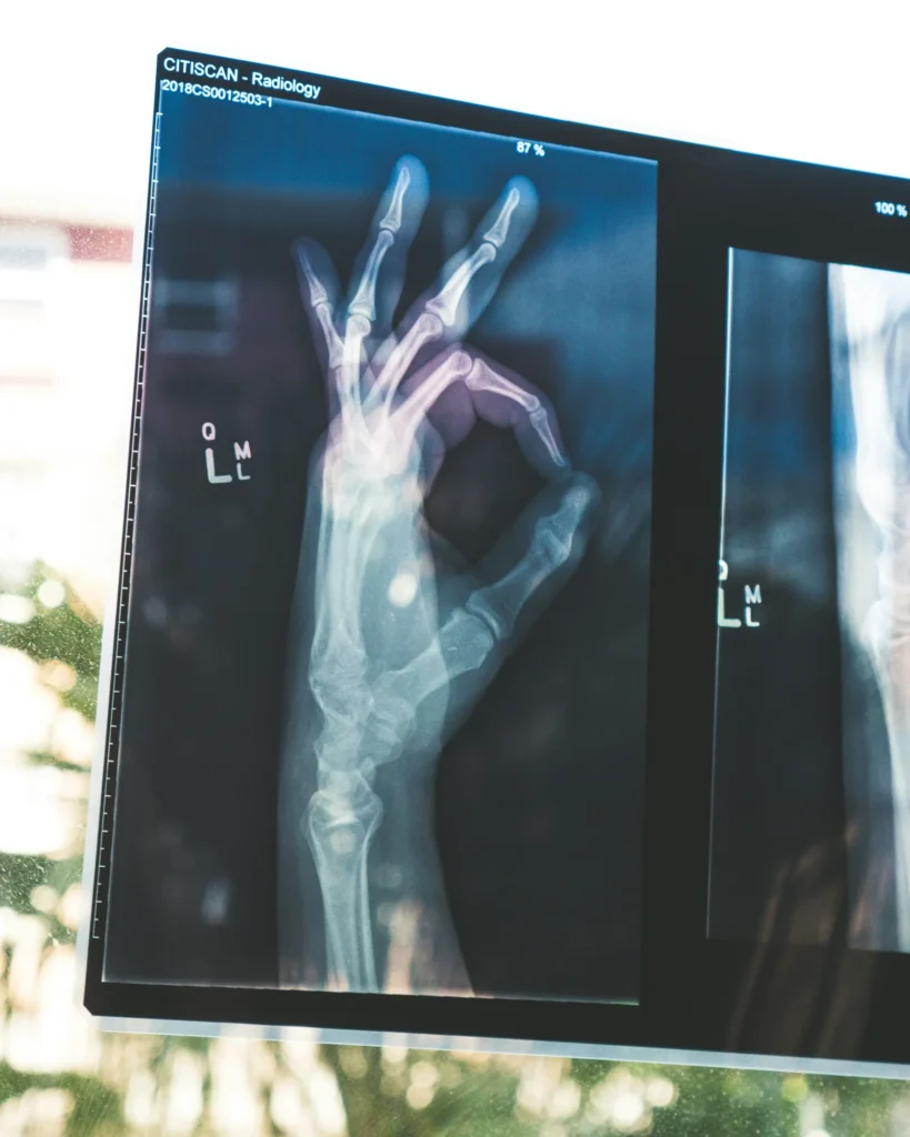 An X-ray image of a hand displayed on a digital medical monitor, representing diagnostic standards and healthcare regulatory compliance.